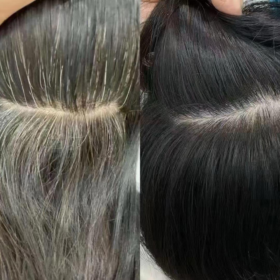 脱发白发找小徐