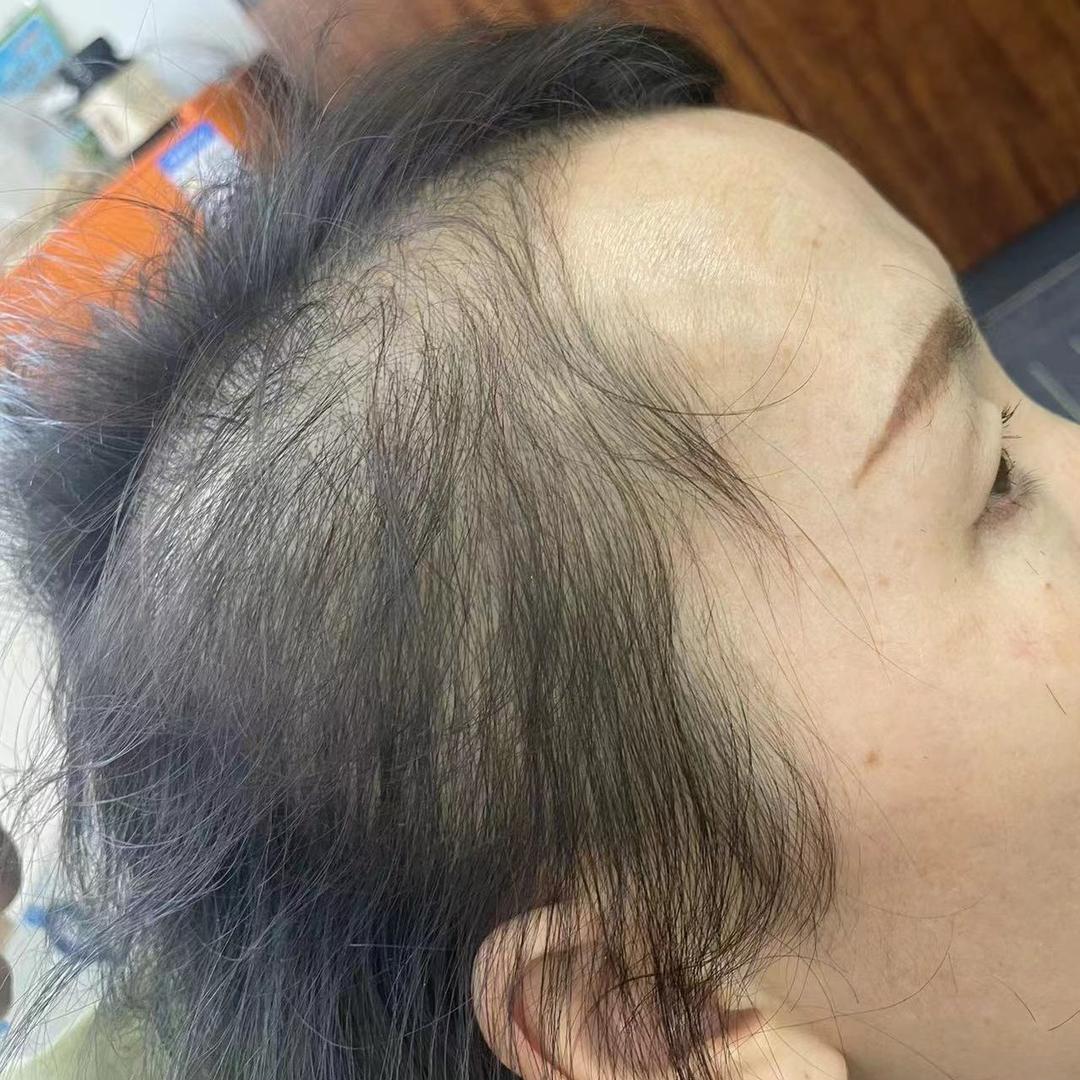 幸运养发