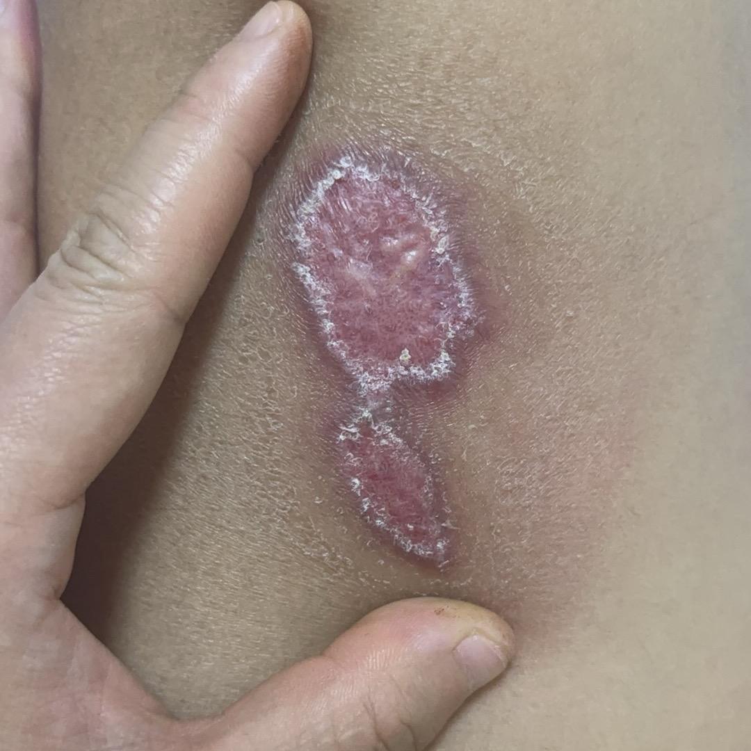 本人已注销账号