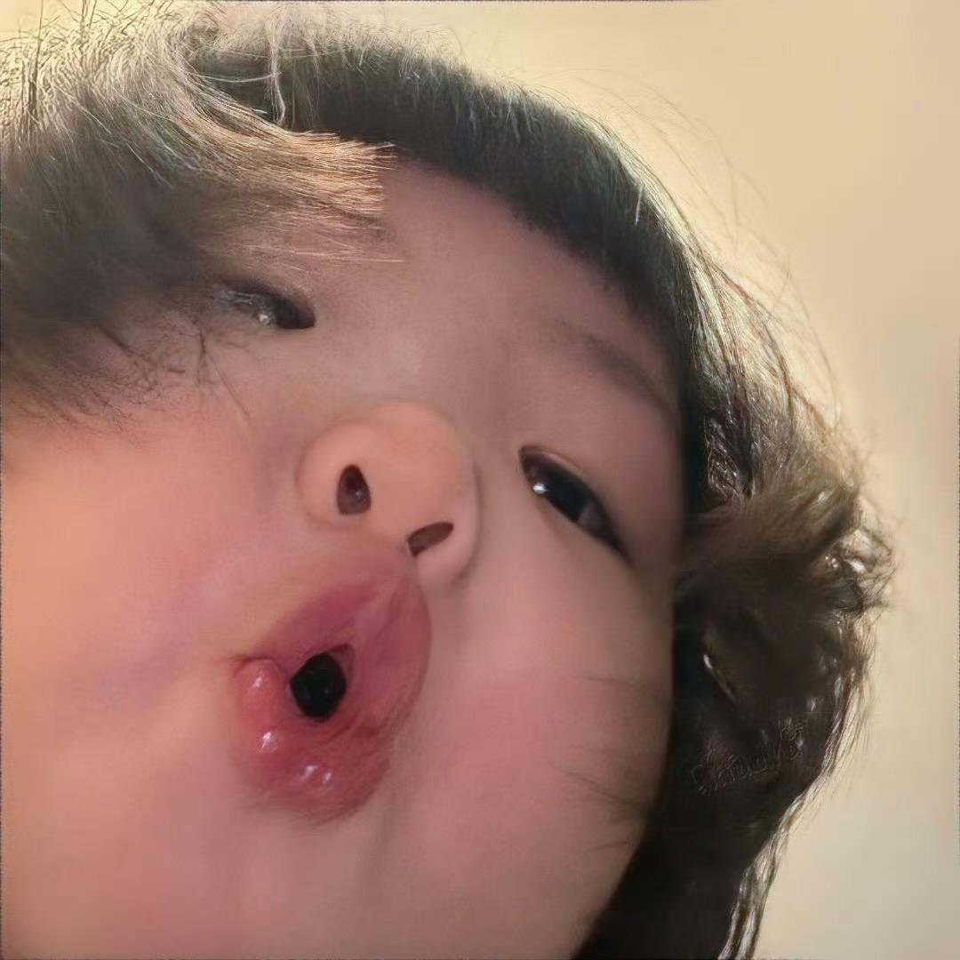 Y