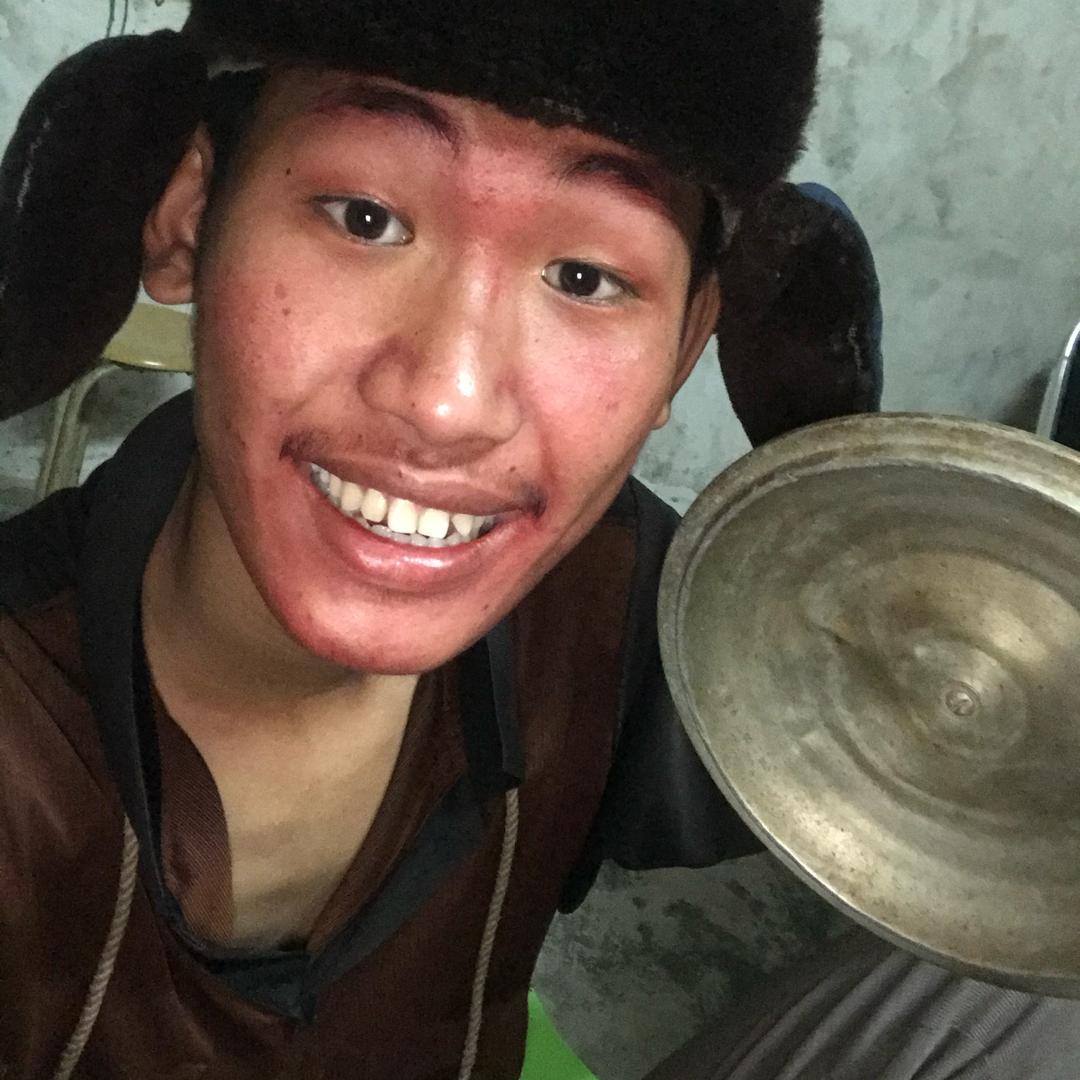 妃傻💥