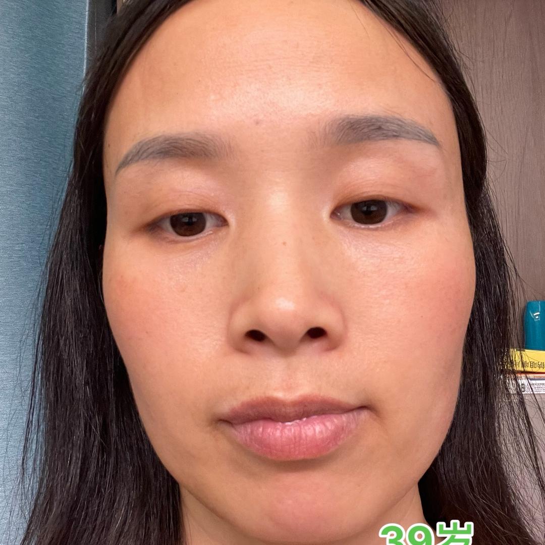 87年兔孙小小全面抗衰变美