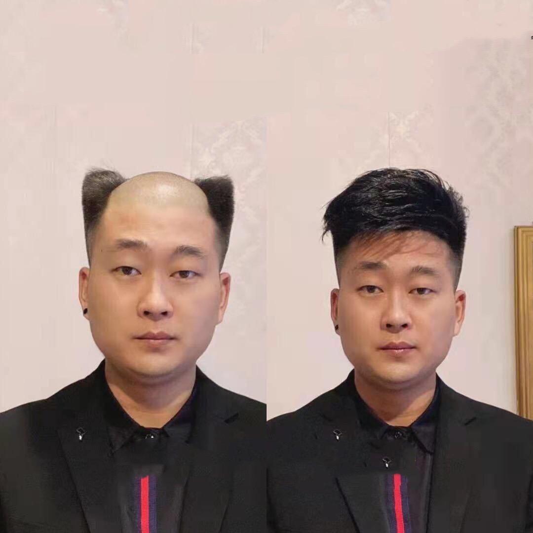 平舆丝美补发假发馆