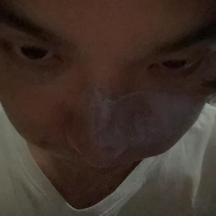 我还活着，真是个奇迹