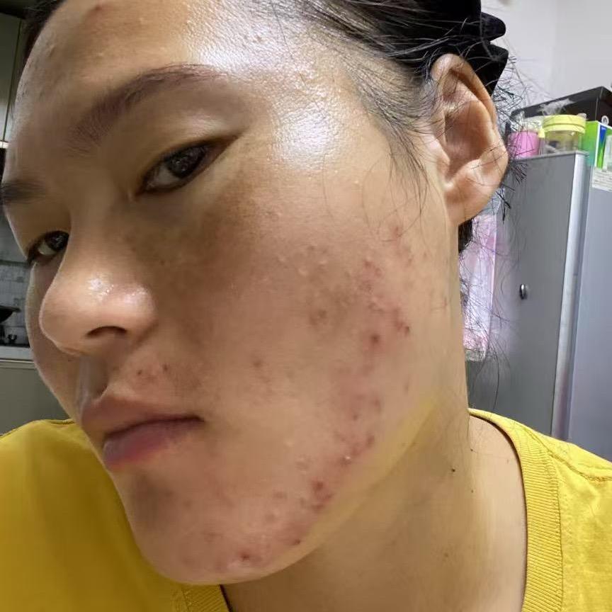 海玲护肤分享