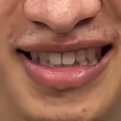 风烛残年