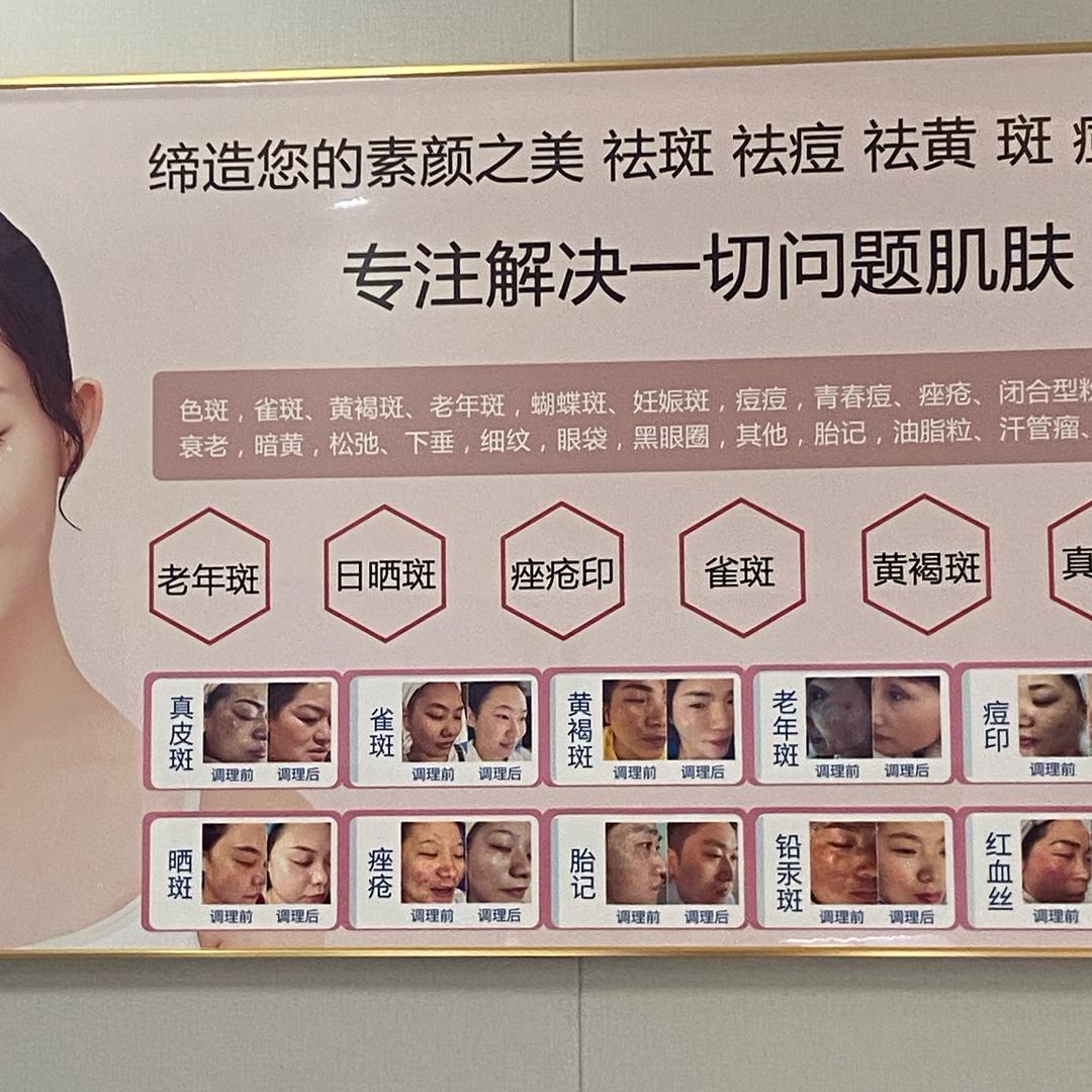 皮肤管理终点站