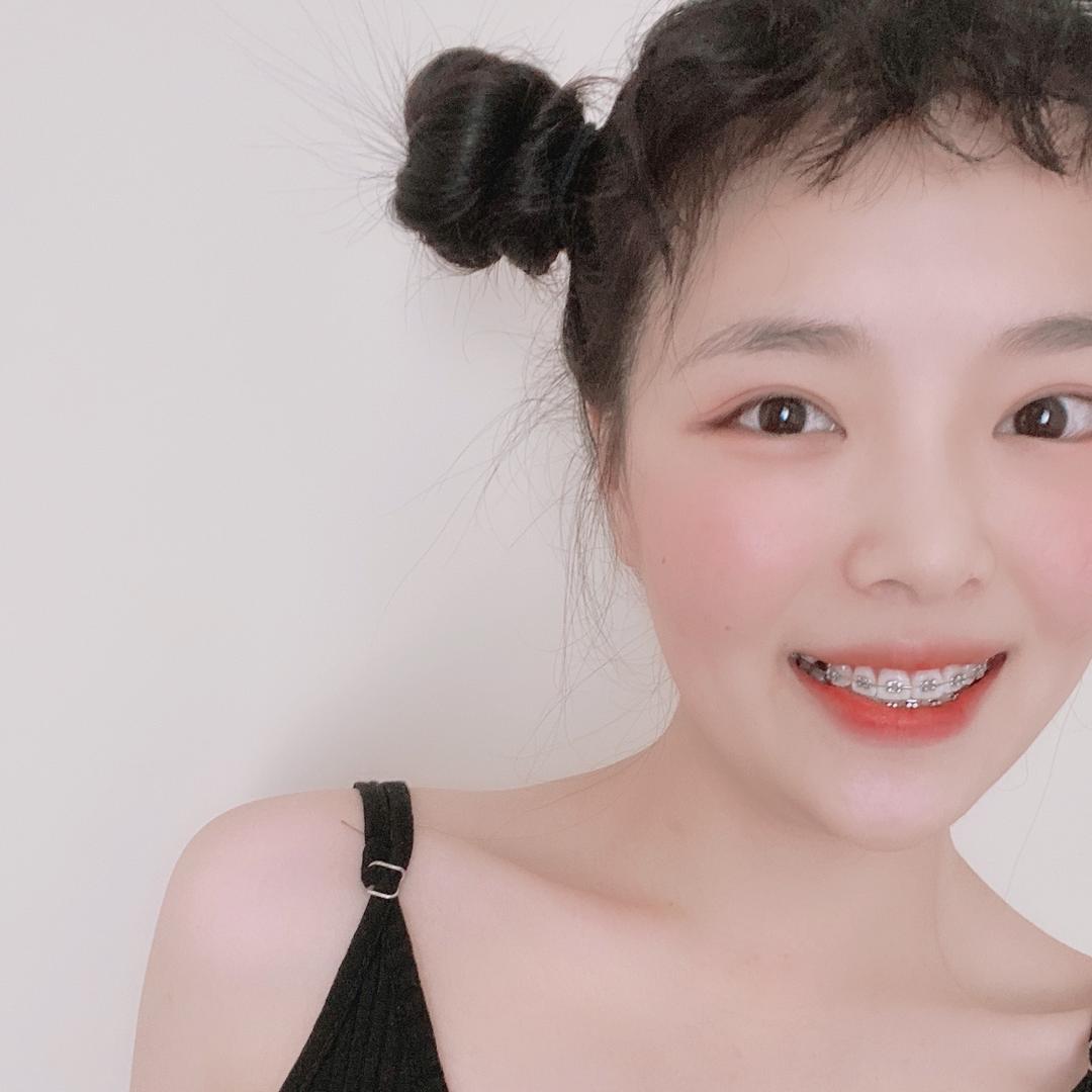 XX