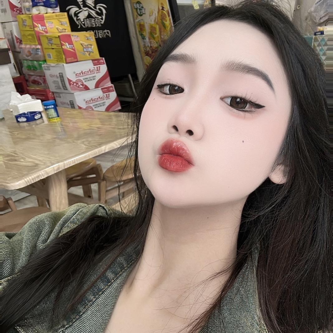 美痣