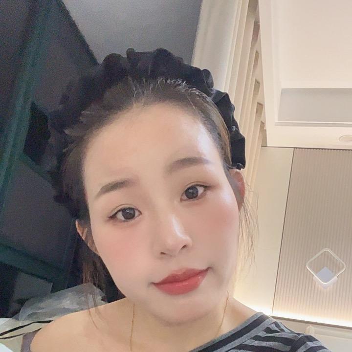 小张158