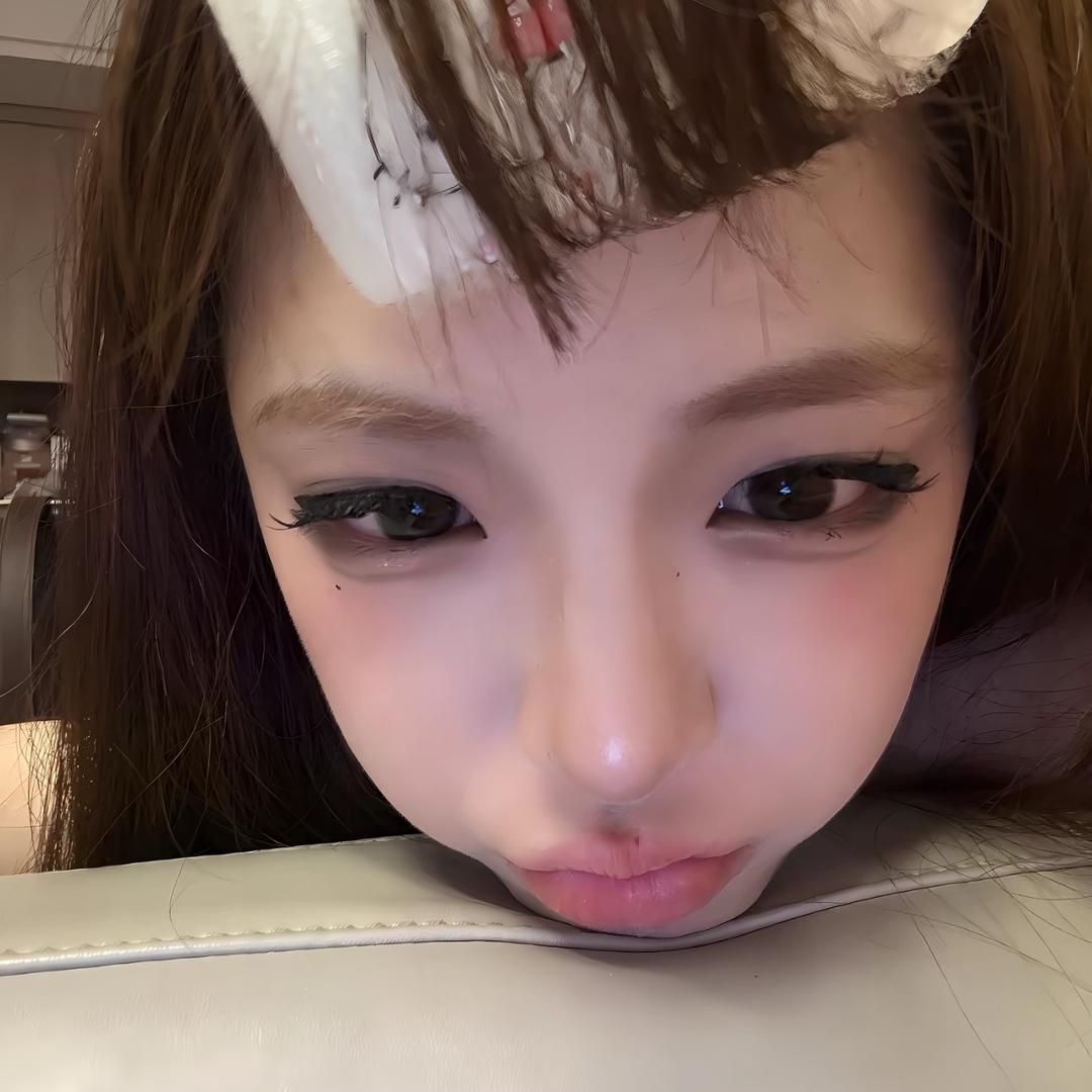 你掉头发了.