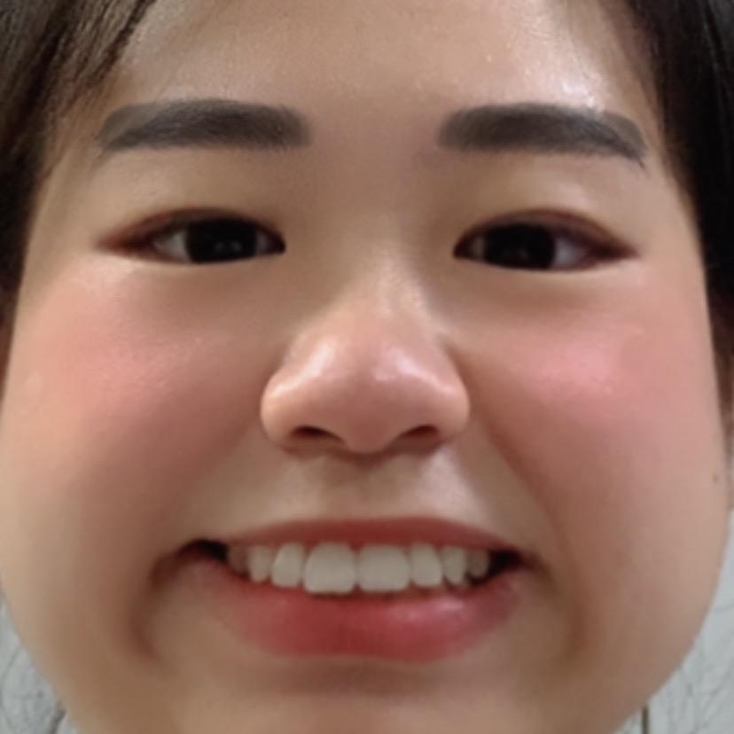 屁屁🐷
