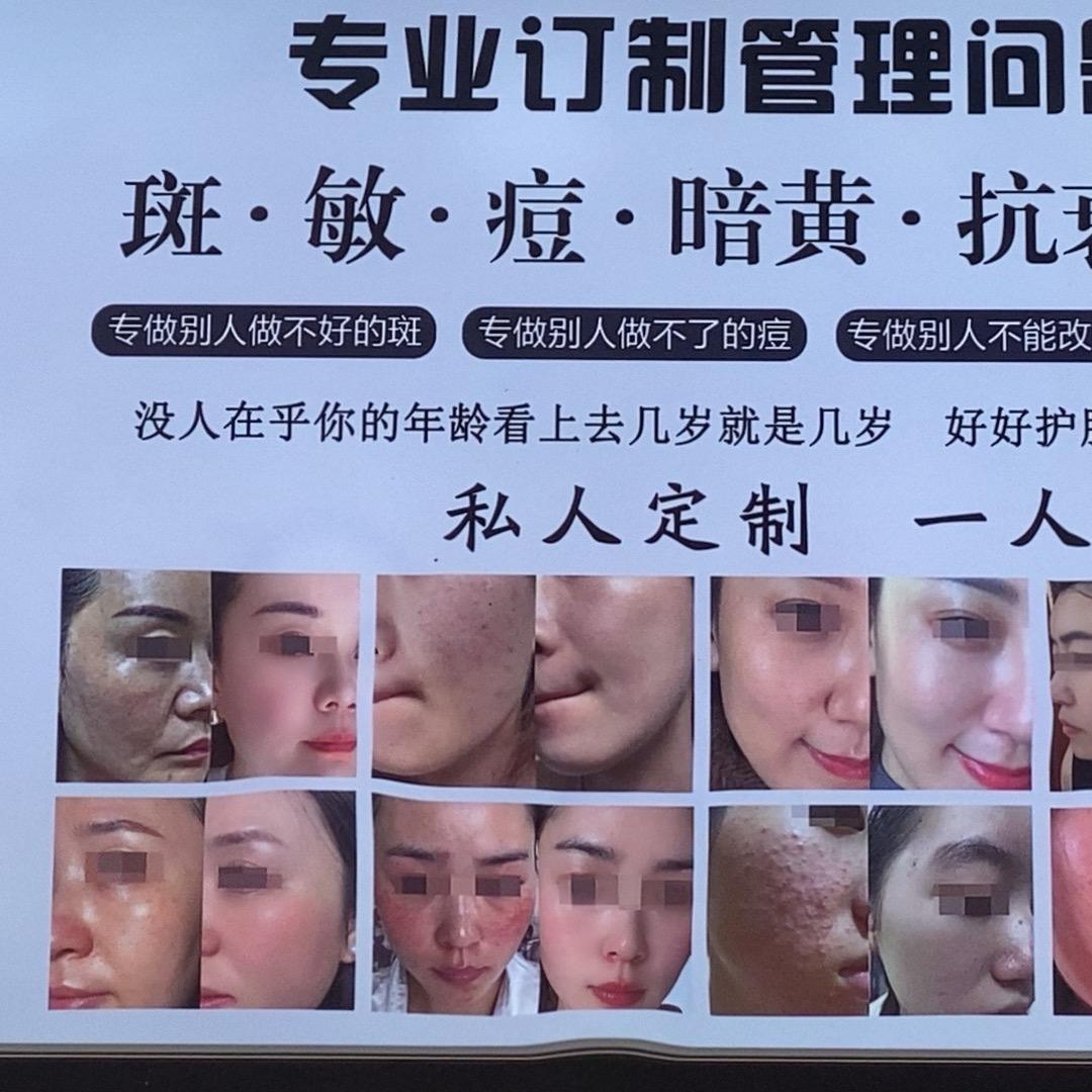 情至于此—专业祛斑