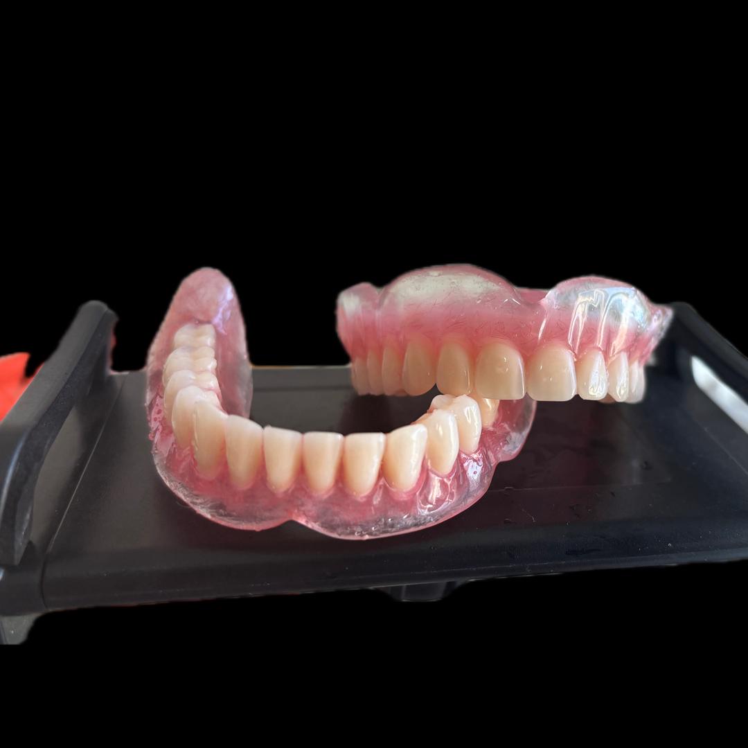 乐乐（全口吸附性义齿）