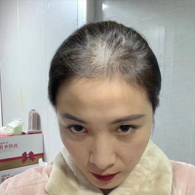 养发达人苗苗