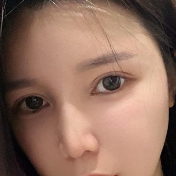 卡卡西斯