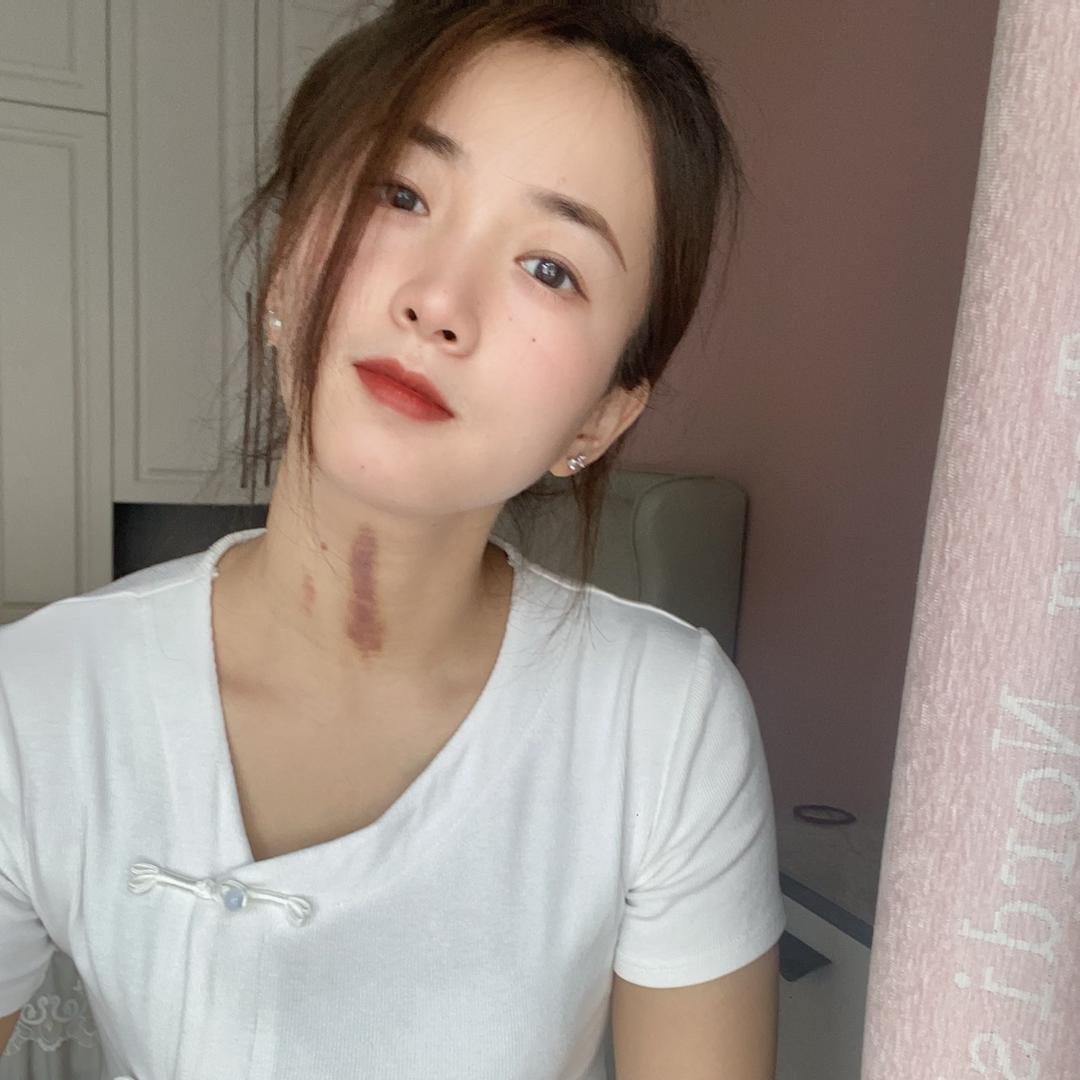 宇哥biubiubiu