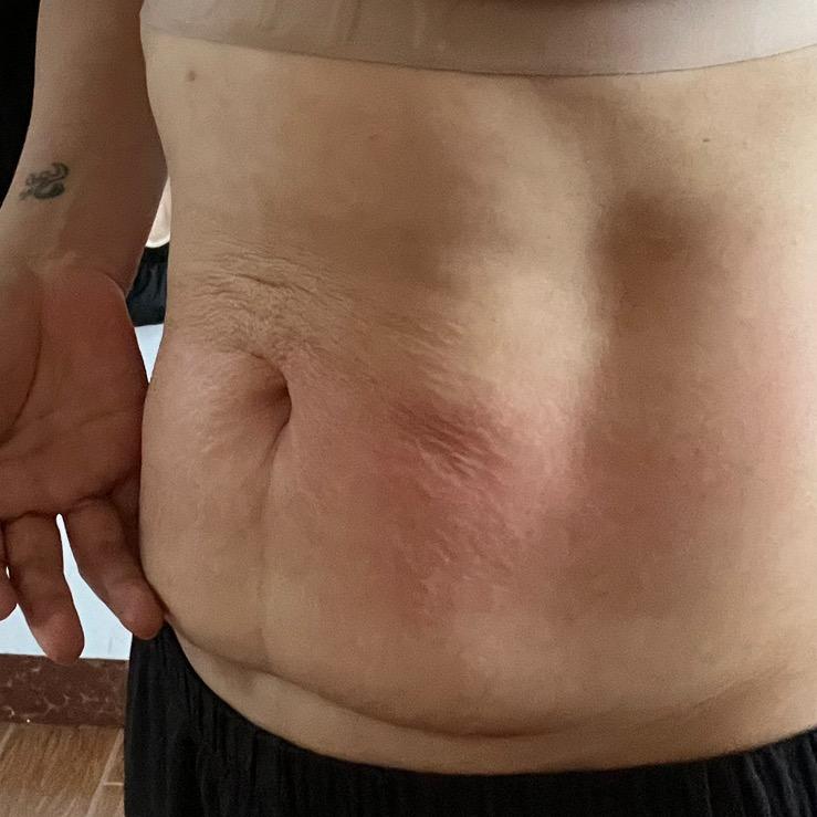 欢欢 捏腹 揉腹 2