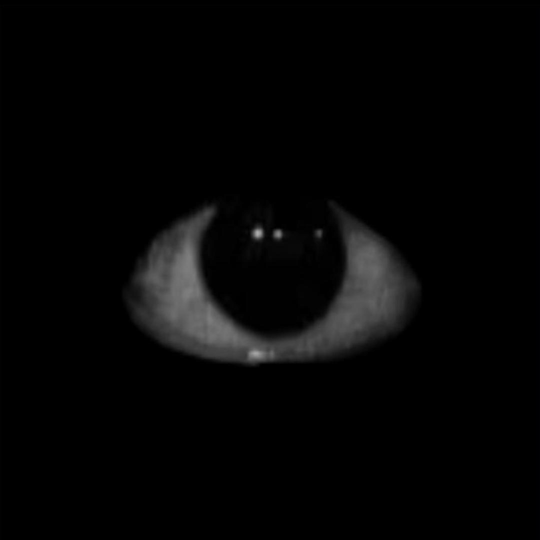 阿尔卑斯的弟弟阿尔卑微