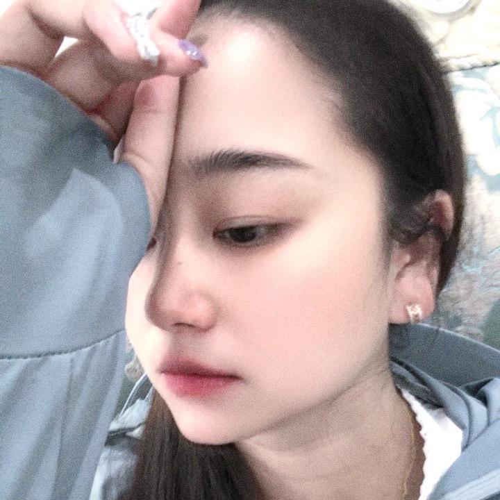 云南伊雪