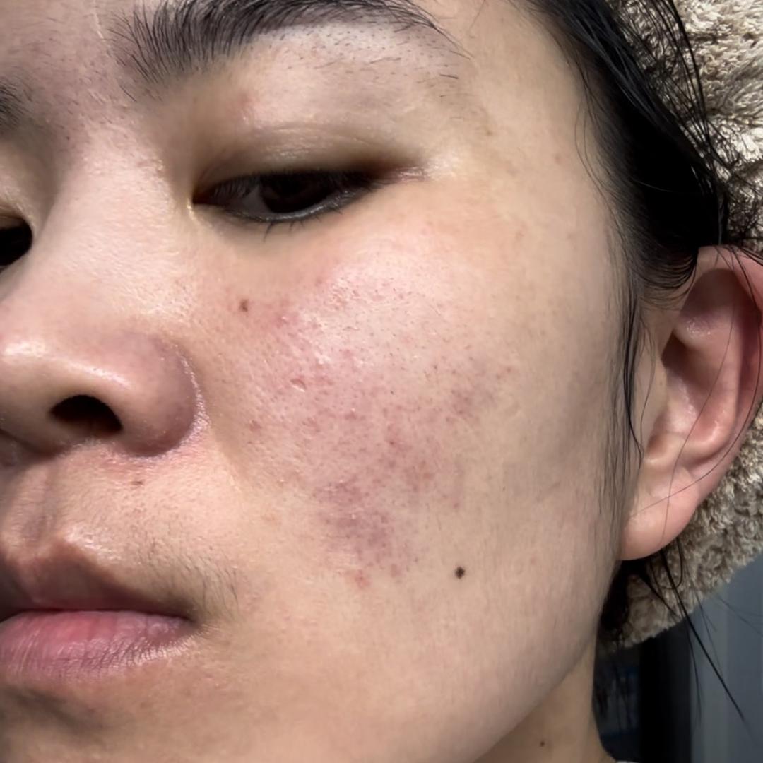 玫瑰小胡（养出城墙皮）