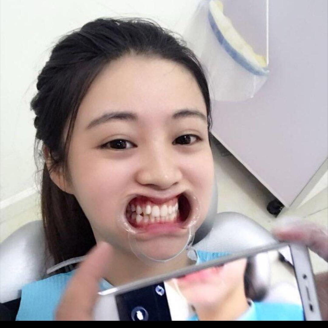 小小101❤️（幸运版）