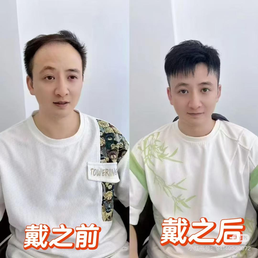 无锡假发