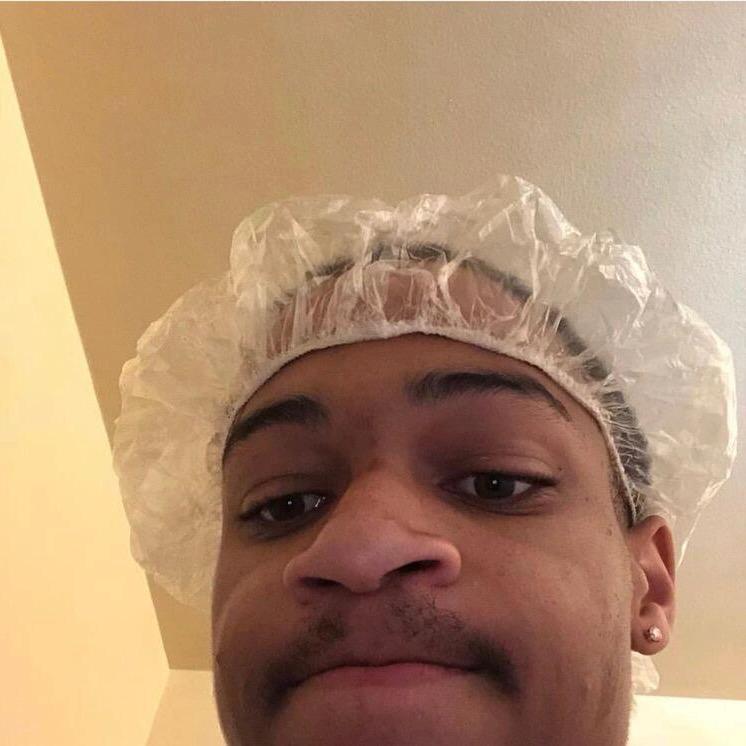 我有好多好多u伤