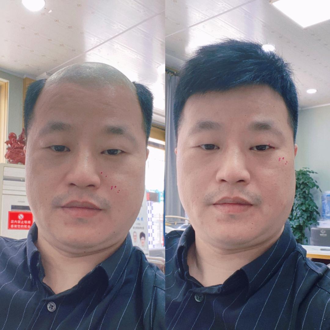 翻盖哥假发定制，收长头发
