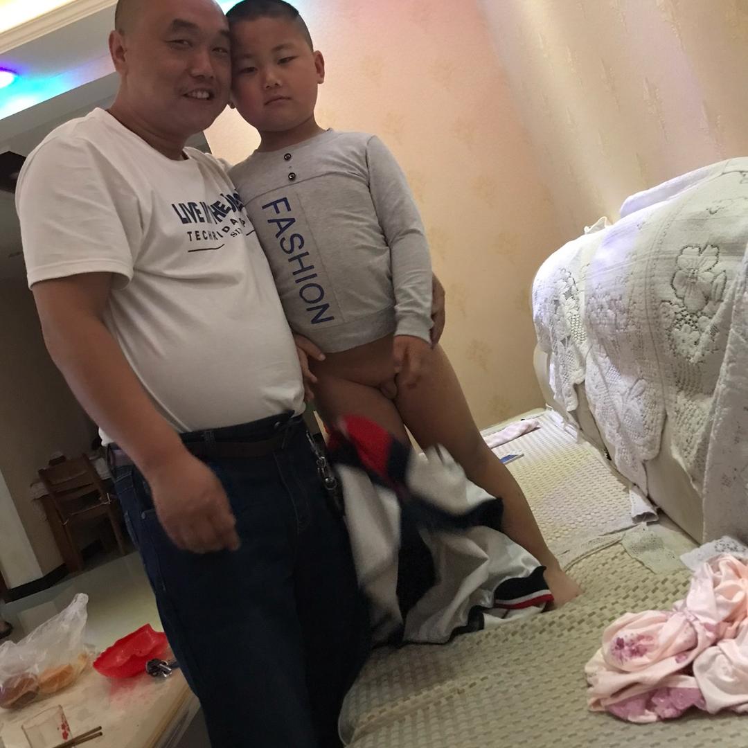 臭蛋