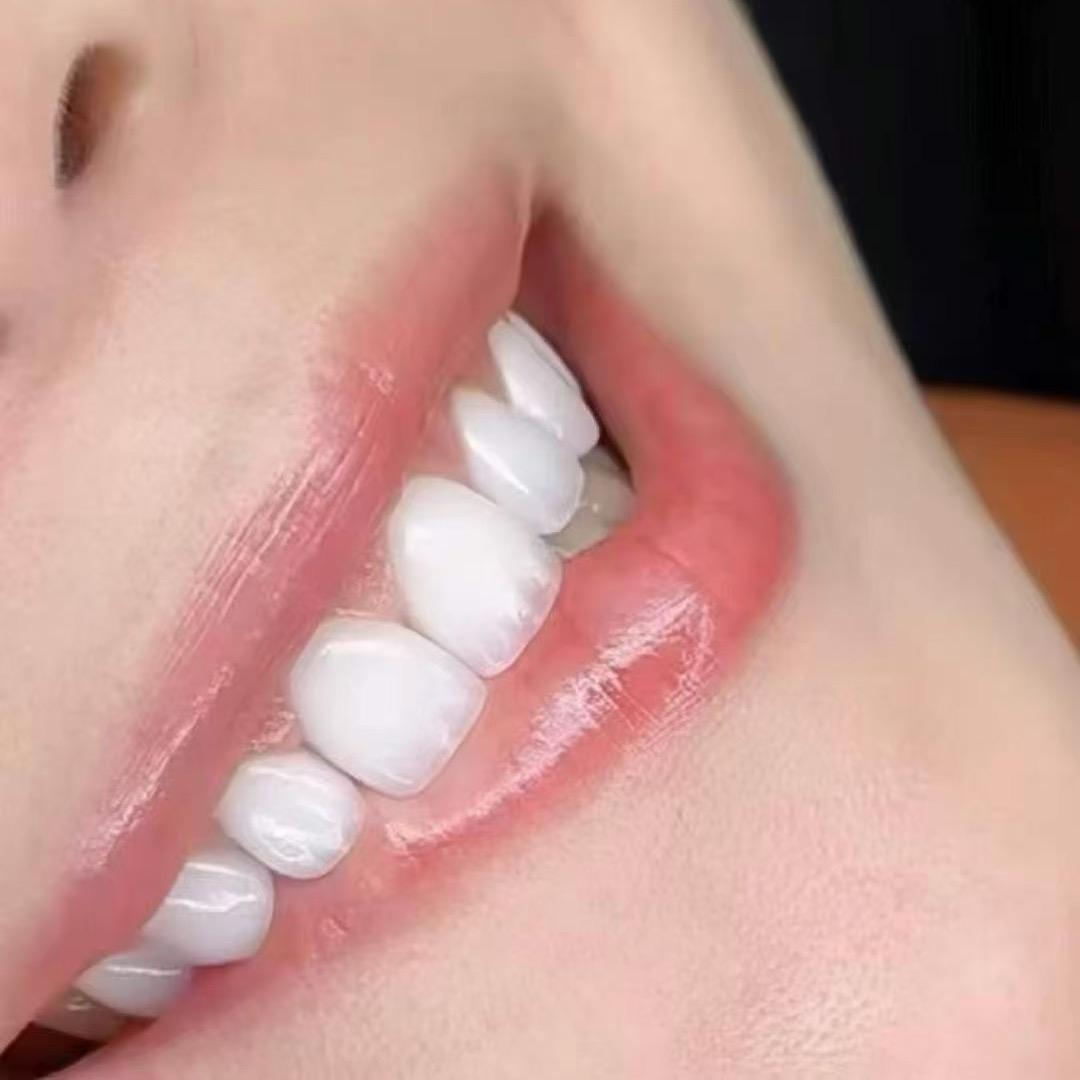 🈴美《口腔》🦷