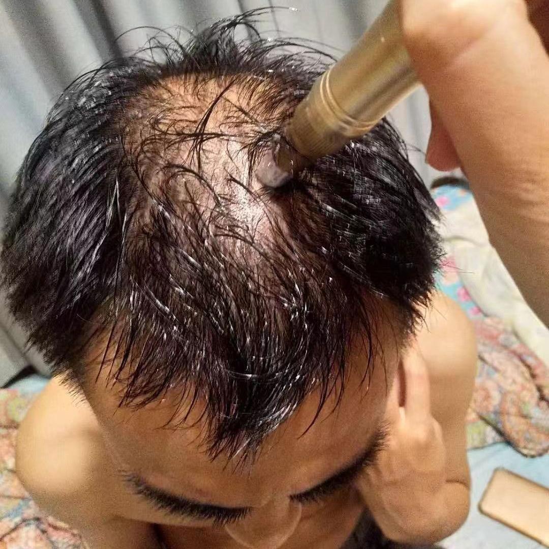 秃头举哥工作室