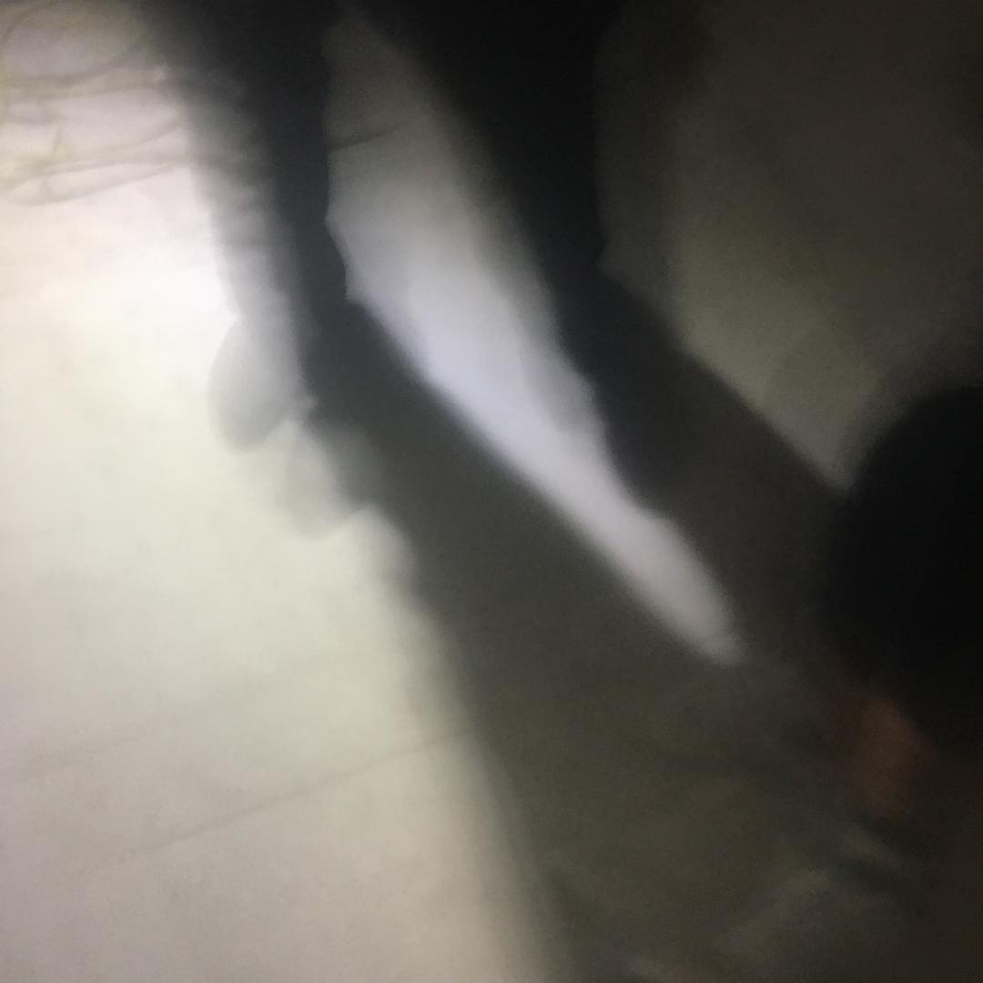 ☞人在江湖飘☜♛哪能不挨刀♛♝