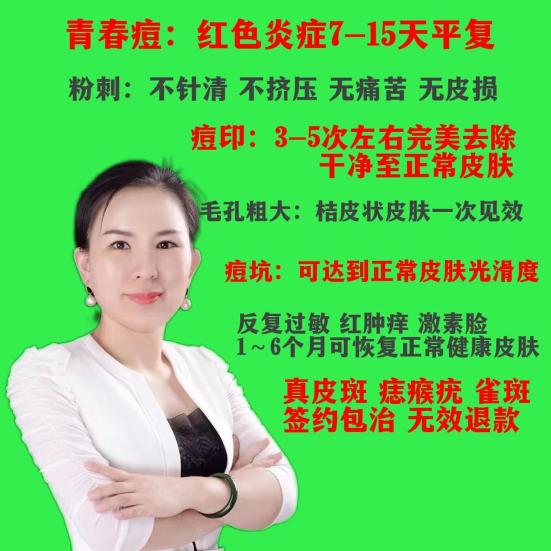 内乡新雨池伟姐祛痘一姐