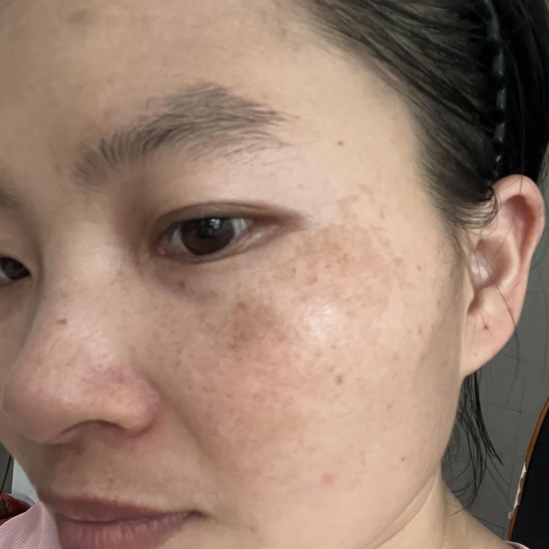 秋秋问题肌甄选