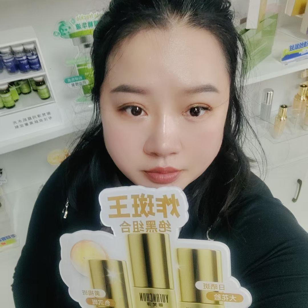 斑敏痘源头工厂兰兰