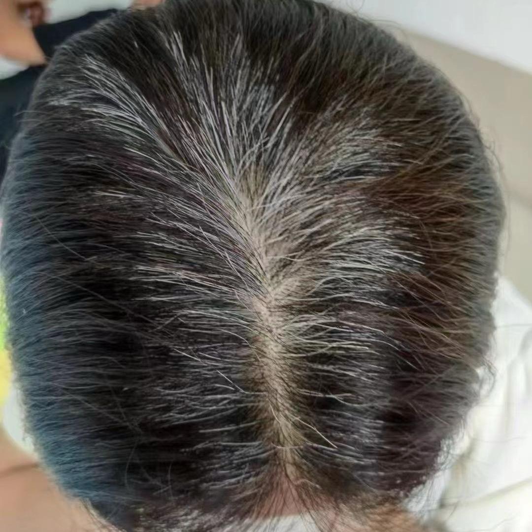 白发养黑（成都）