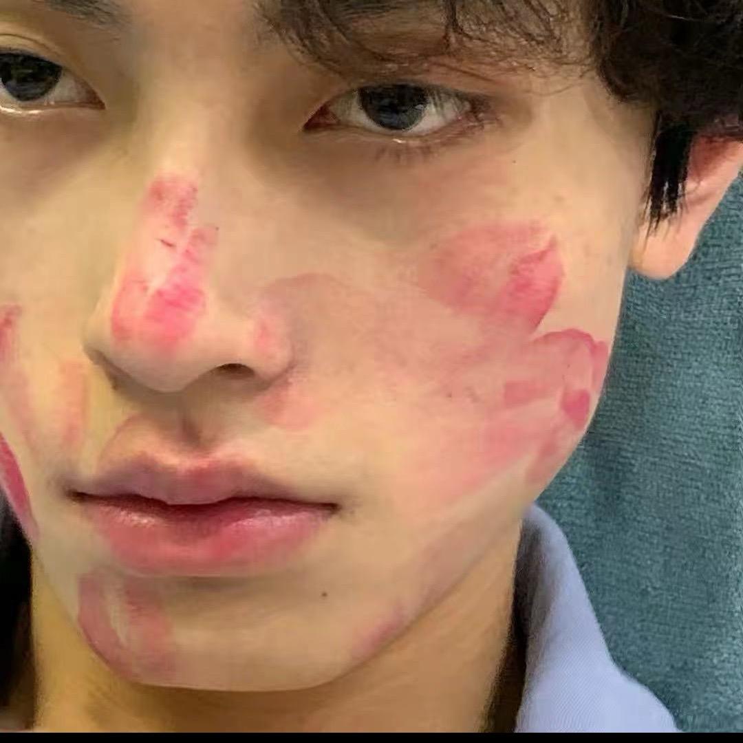 活