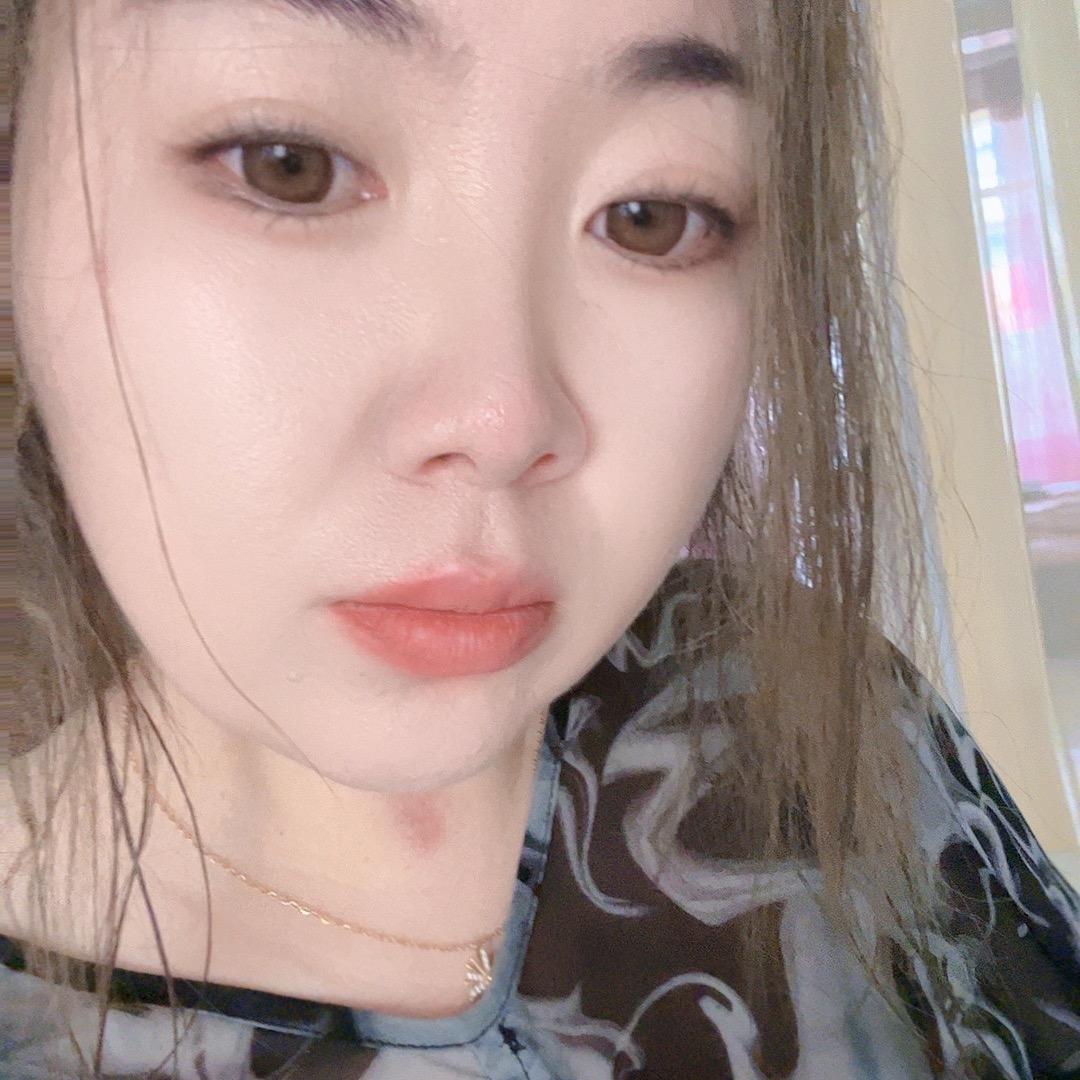 我