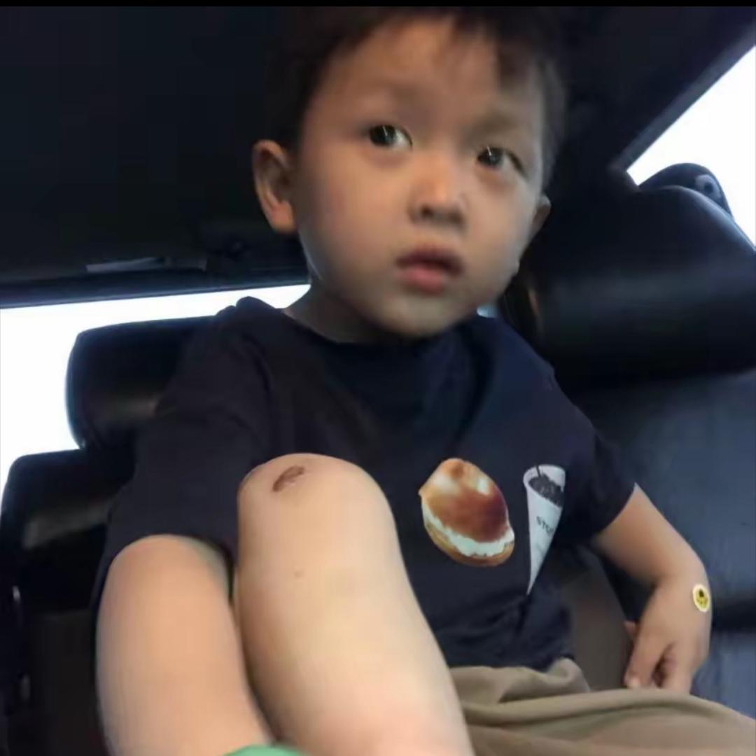 c-y