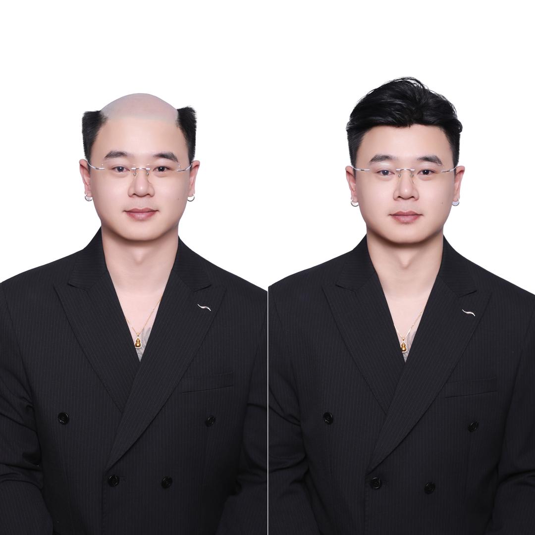 潍坊假发定制·洪良