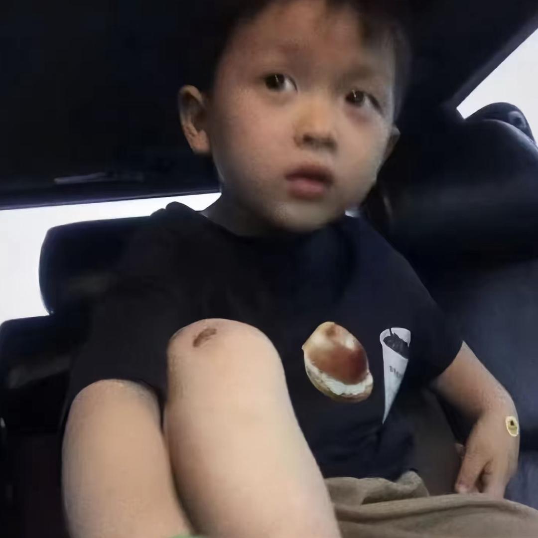 关…