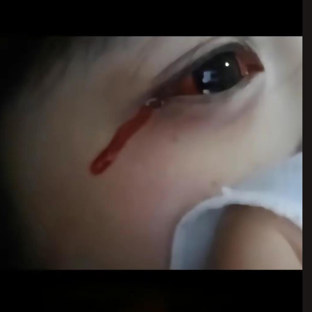 好了伤疤忘了疼