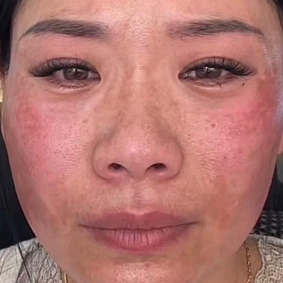 燕子祛斑失败（修复中）