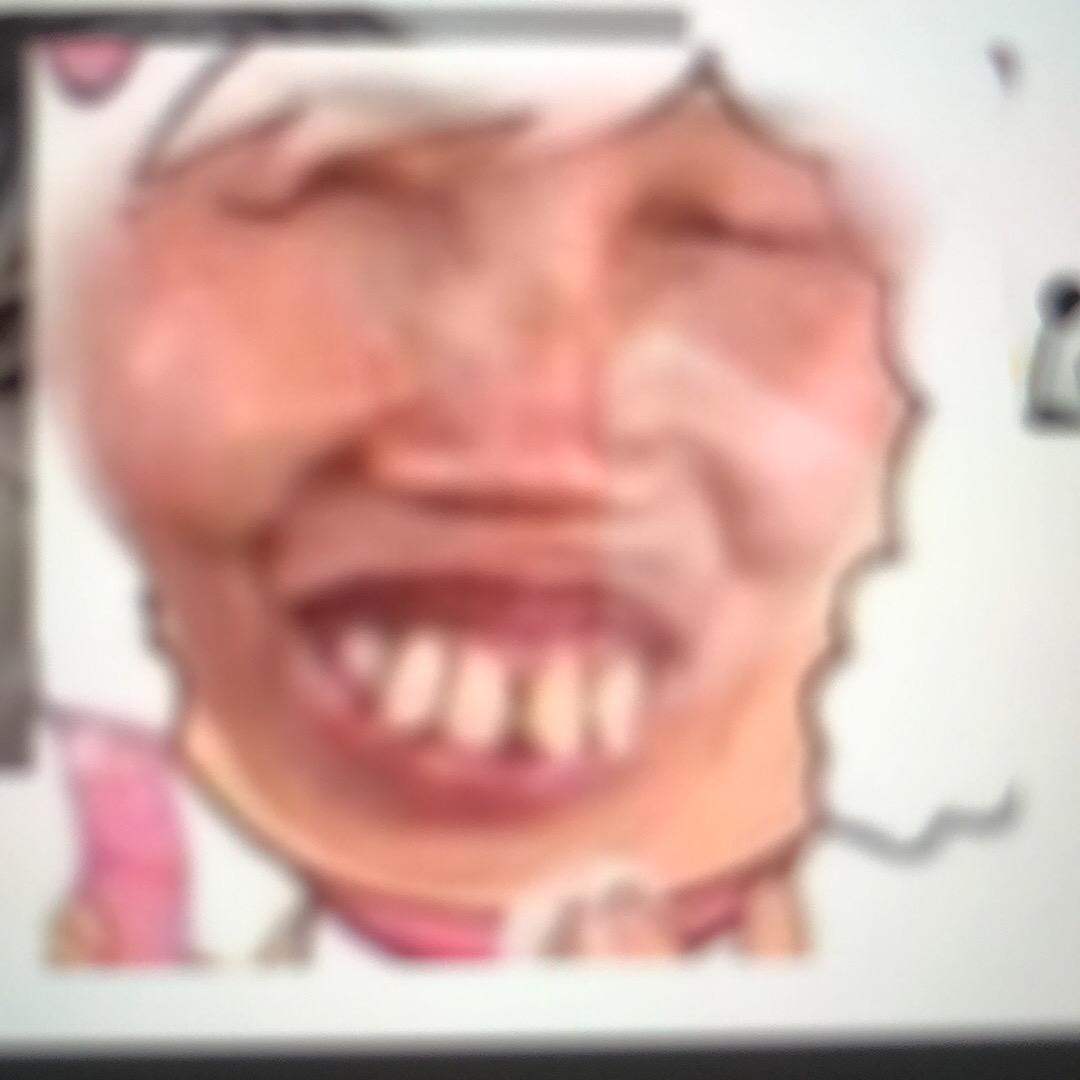 大矮子