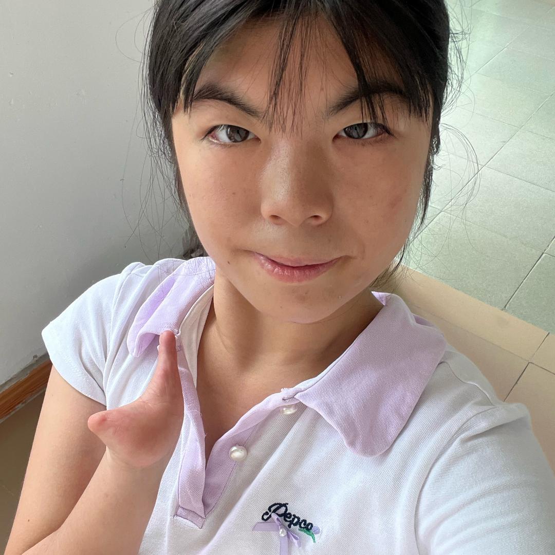 残疾女孩晴晴
