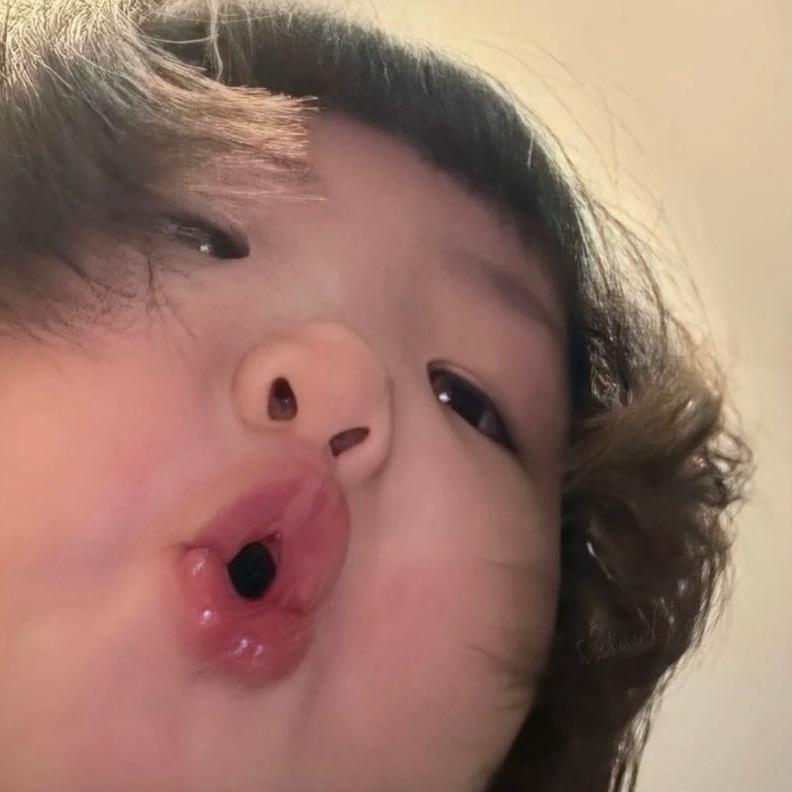 Y__
