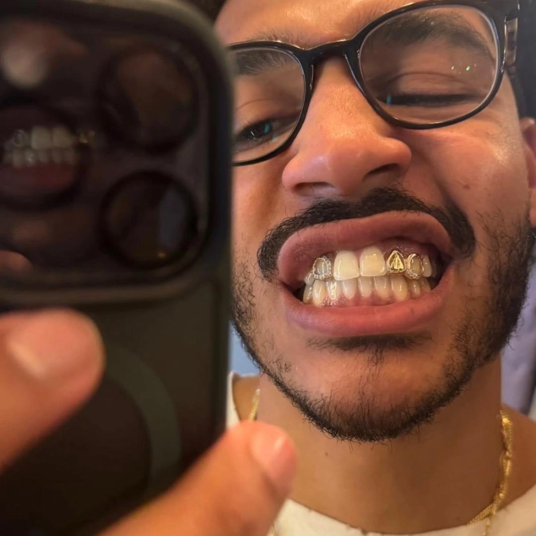 🪼