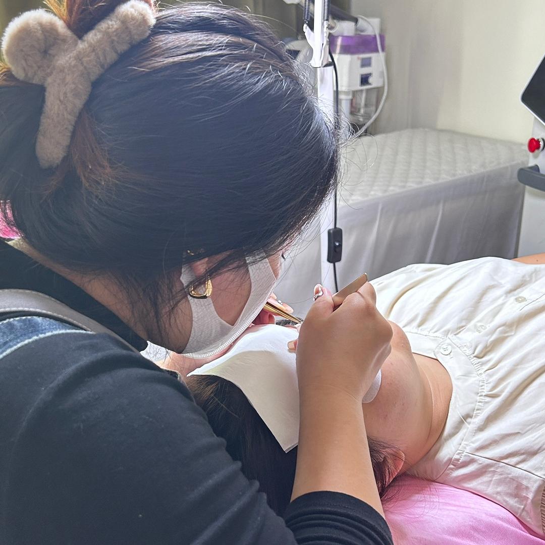 小林不小😊嵌甲矫正🦶