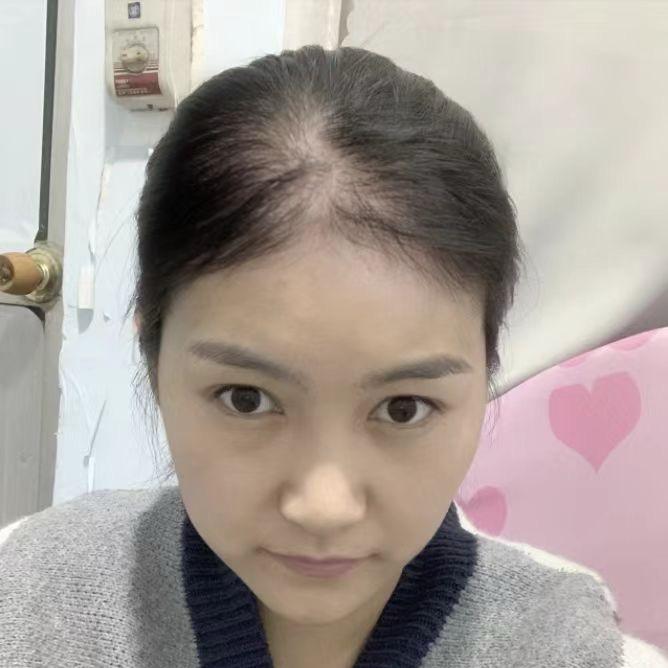 西西（专注防脱养发浓密）